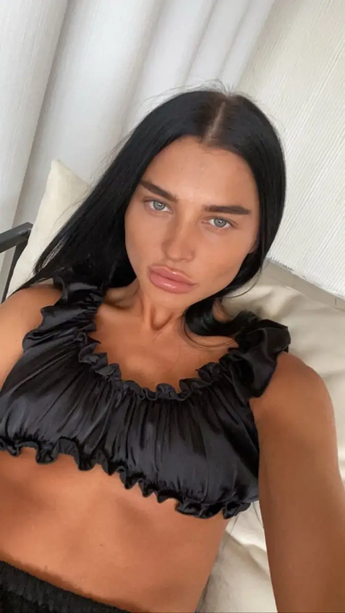 Albinos escort in Dubai