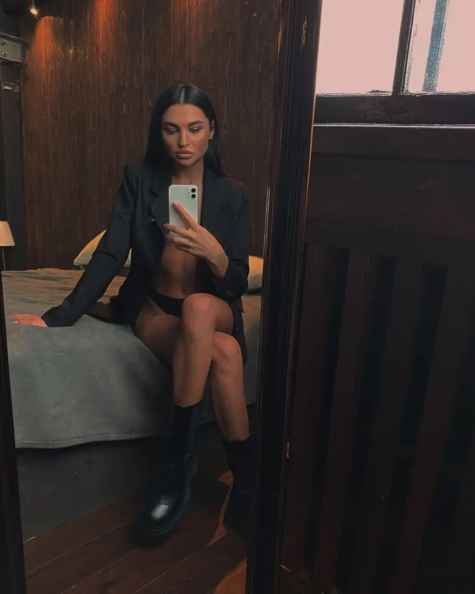 Albinos escort in Dubai